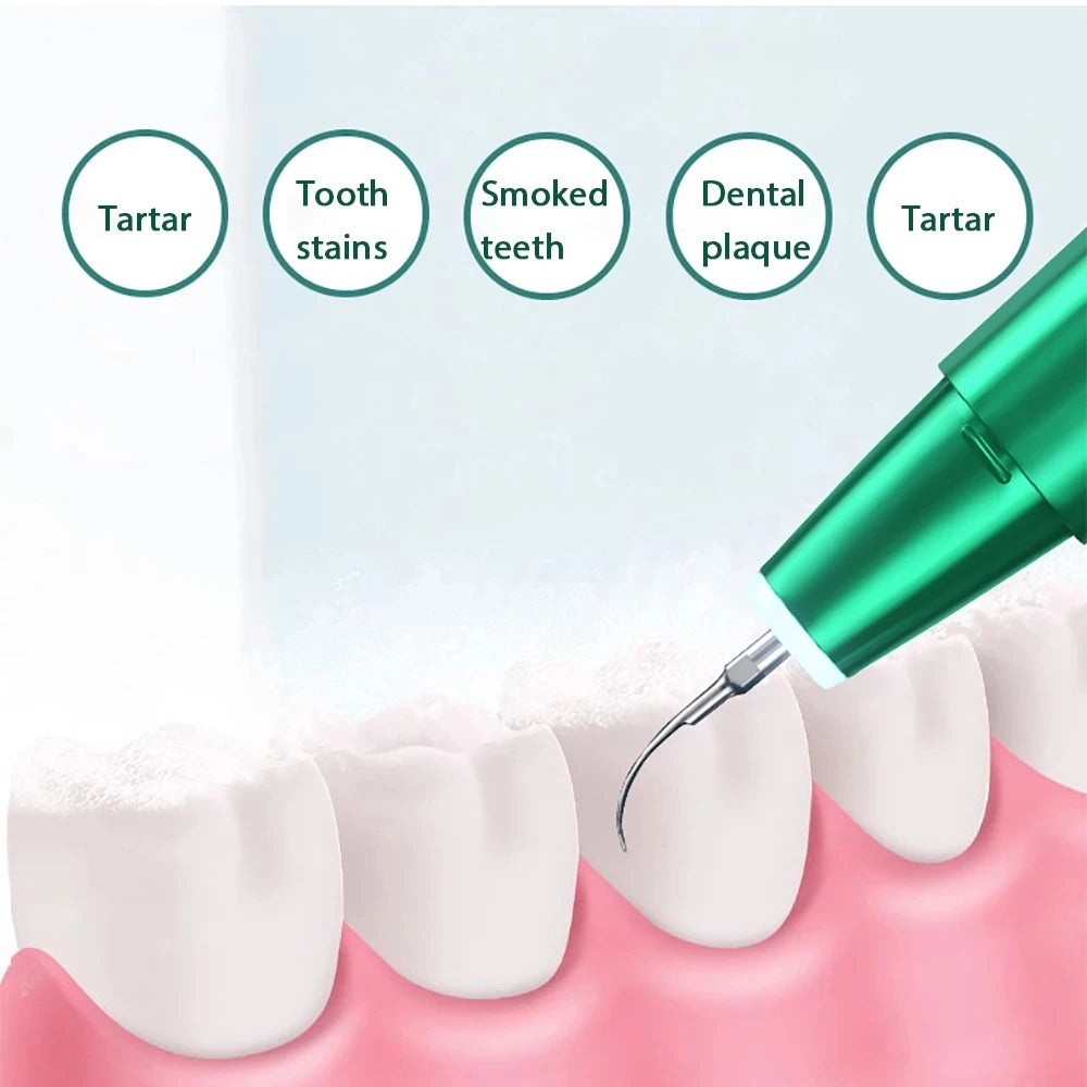 XB Ultrasonic Teeth Scaler & Stain Remover