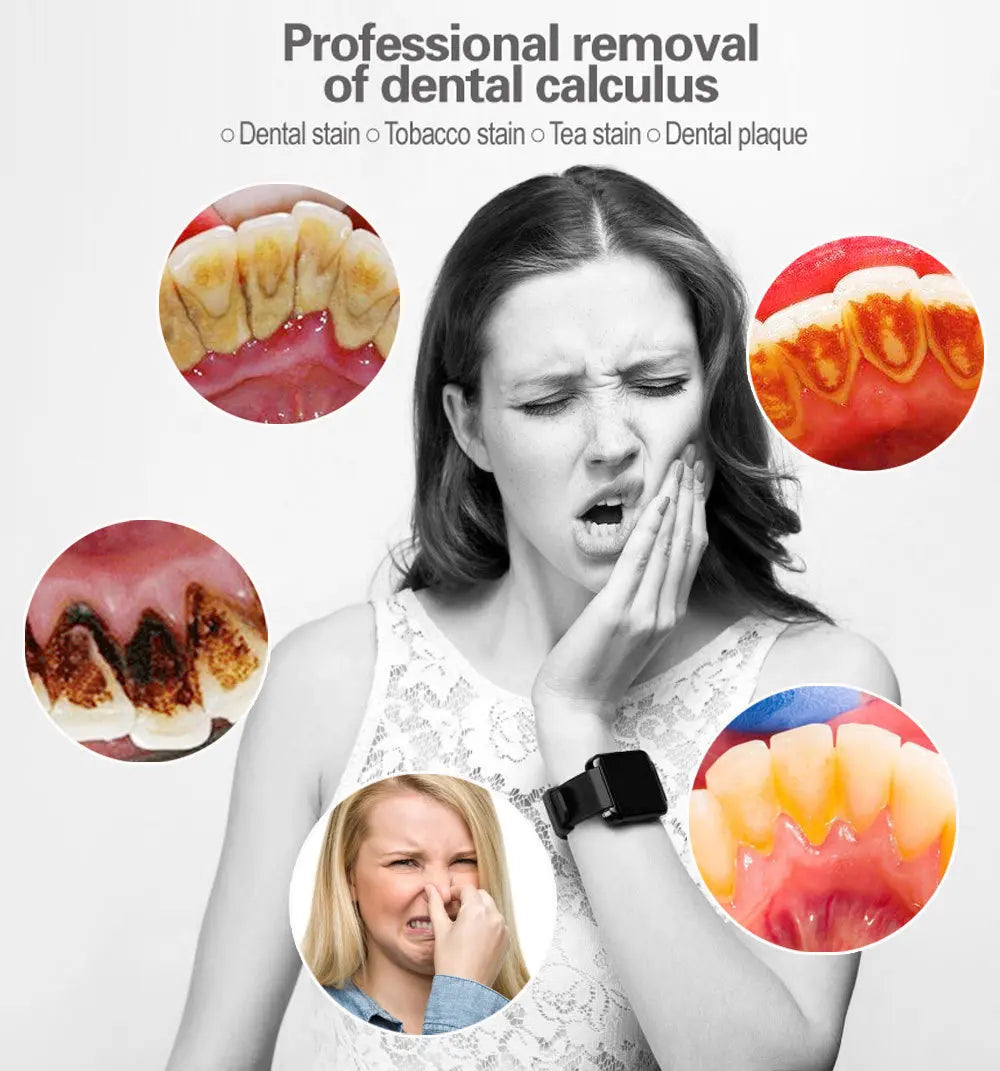 XB Sonic Electric Toothbrush & Teeth Scaler